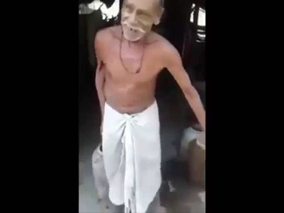 Man with the rubber hand