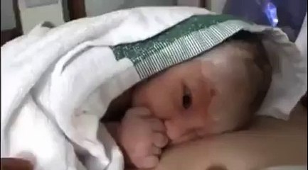 doğduğunda şeklini koyan çocuk (parmağa dikkat)