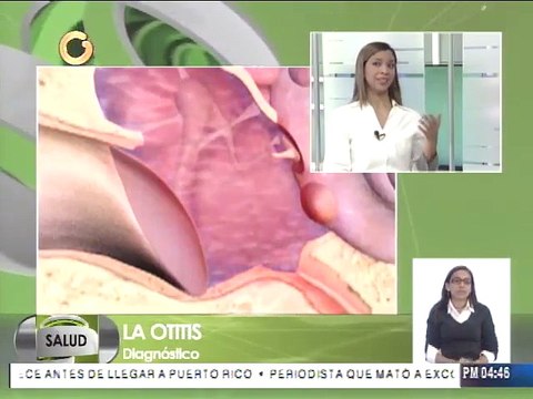 ¿Cómo se diagnostica la otitis media durante la infancia?