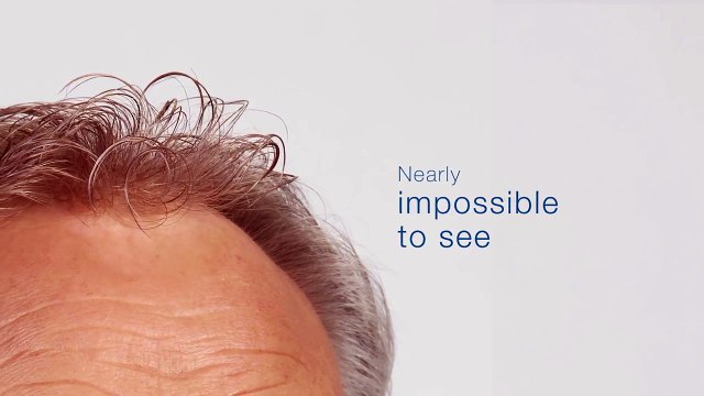 Introducing HD Skin: Revolutionizing Thin Skin Hair Systems for Men | Hair Direct