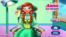 Disney Frozen Games - Anna Eye Treatment - Disney Frozen Games for Girls