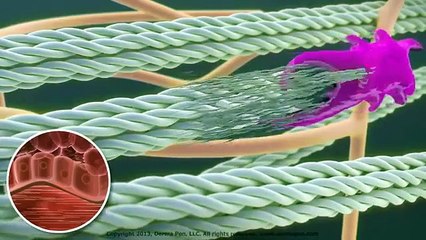 Dermapen Micro Needling Treatment of Acne Scars Animation by Needlelogic com