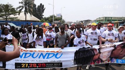 RDC: les albinos en quête de reconnaissance