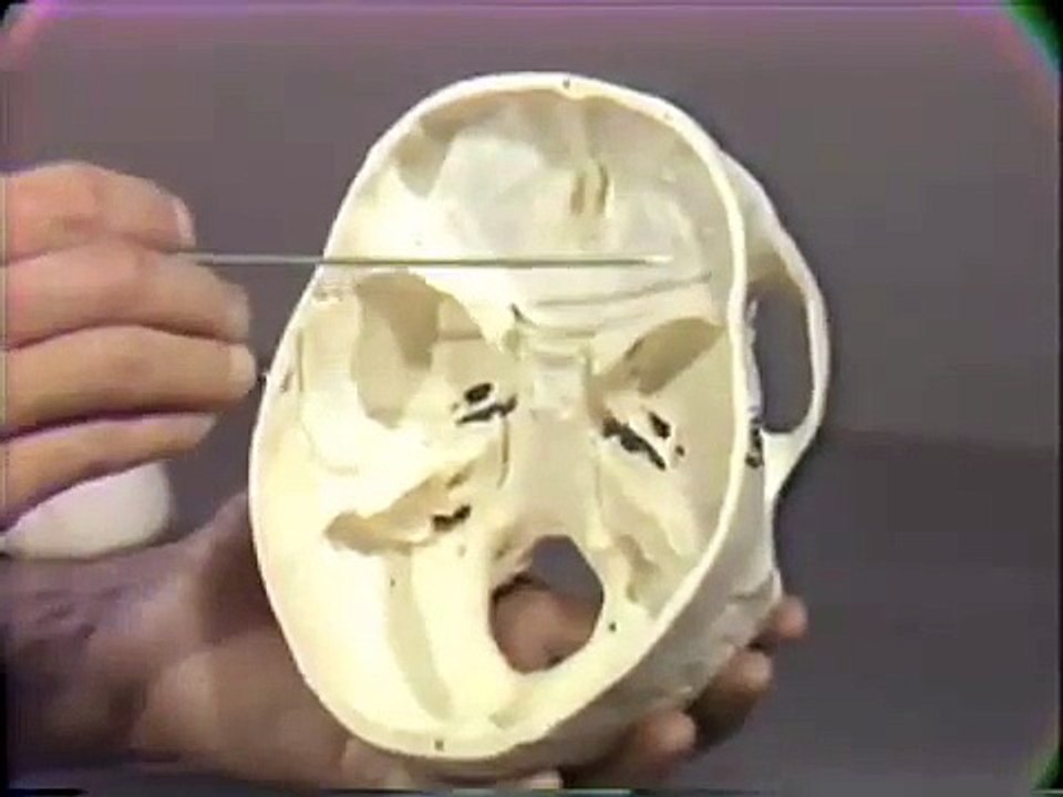 Dissection: Human Skull - Part III