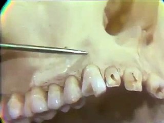 Dissection: Human Skull - Part II