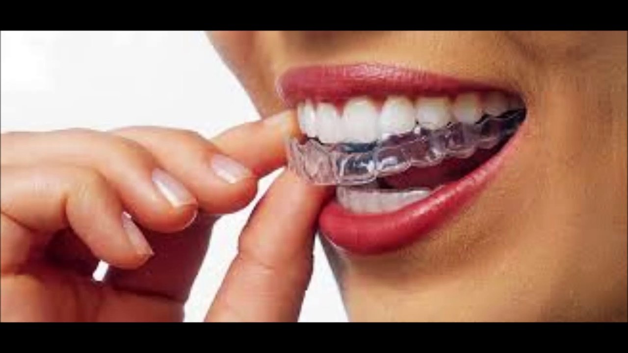 Orthodontist Davis