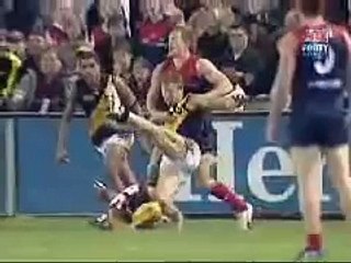 AFL Player Nathan Brown Breaks Leg