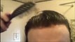 Non surgical men's hair replacement - custom-made pieces