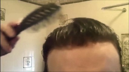 Non surgical men's hair replacement - custom-made pieces