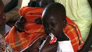 Hambre: la realidad cotidiana de los niños en Sudán del Sur