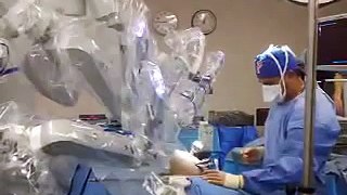 Docking Robotic right hemicolectomy, Dr Douglas A Brewer