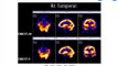 fMRI vs PET vs SPECT - functional neuroimaging
