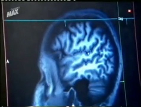 Criminologia (1): Daño cerebral (Jonathan Pincus)