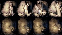 Kako fetus reaguje kada mama pusi u toku trudnoce