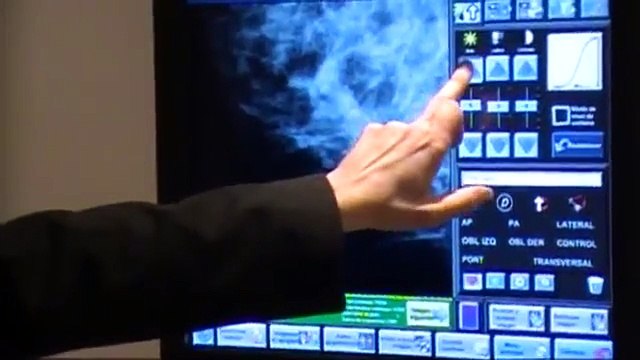 Mamografia y ultrasonido