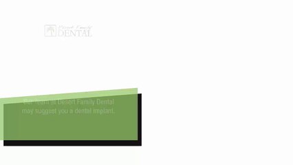 The Advantages Of Opting For Dental Implants