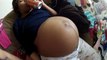 ✔All about twin pregnancy Twin pregnancies Part 1 임신 건강,Santé enceinte,صحة الحامل