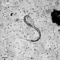 white blood cells attack a parasitic worm