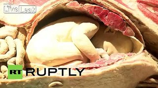 Germany: Human BODY PART expo finds final resting place in Berlin *GRAPHIC*