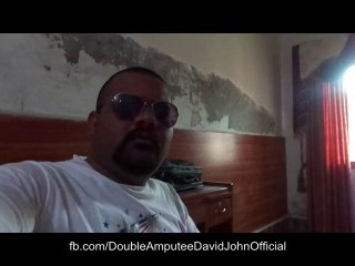 Double Amputee David: First day in Multan