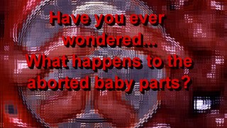 What happens to aborted baby parts?
