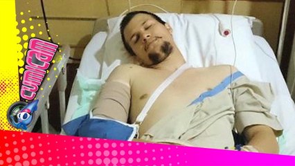 Kecelakaan, Stuart Patah Tulang - Cumicam 04 September 2015