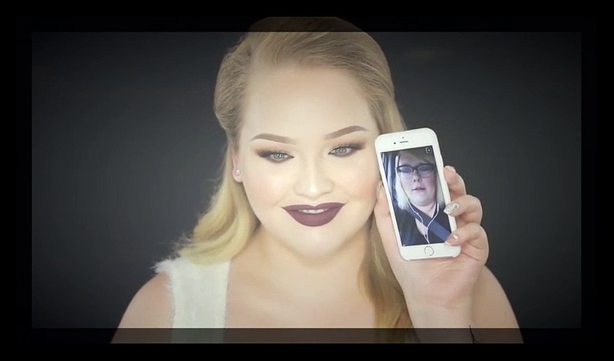 MY LIP INJECTIONS   Q&A!