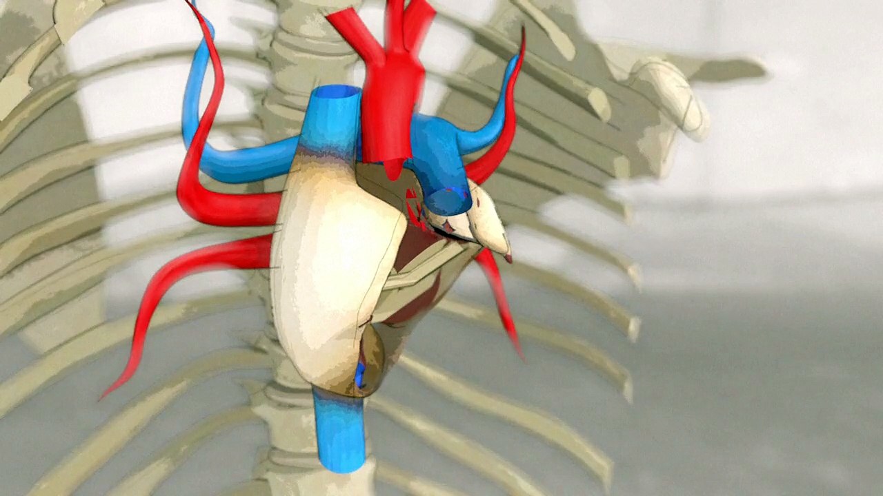 Artificial hearts