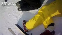 Skiing Accident - Crying, Screaming and Drama!