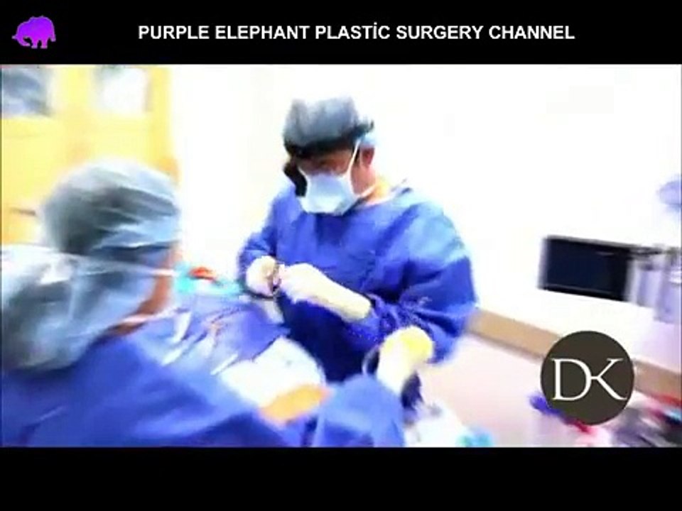 Brustvergrößerung Entfernung Video ersetzen und Aufzug