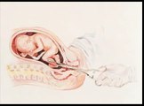 Partial-Birth Abortion Illustrated Video The Crime of Crimes / Pro-Life Anti-Abortion Film