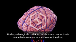 Normal Vascular Anatomy and Dural Arteriovenous Fistula (DAVF)