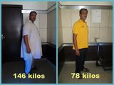 Patient lost 70 Kilos after Mini Gastric Bypass | Weight Loss Surgery