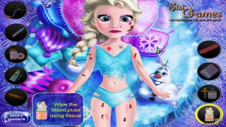 Kids & Children's Games to Play - Injured Elsa Frozen ♡ Top 2015 Online Cartoon play