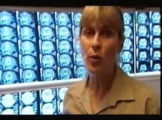 Steve Irwin's Poor Dog Sui, Her Last & Final Chapter (Pt2)