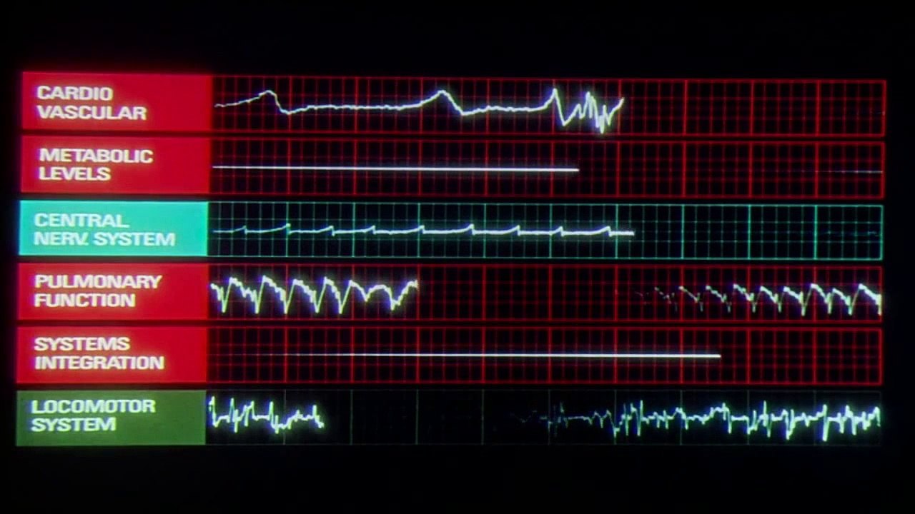2001: A Space Odyssey. "HAL 9000"
