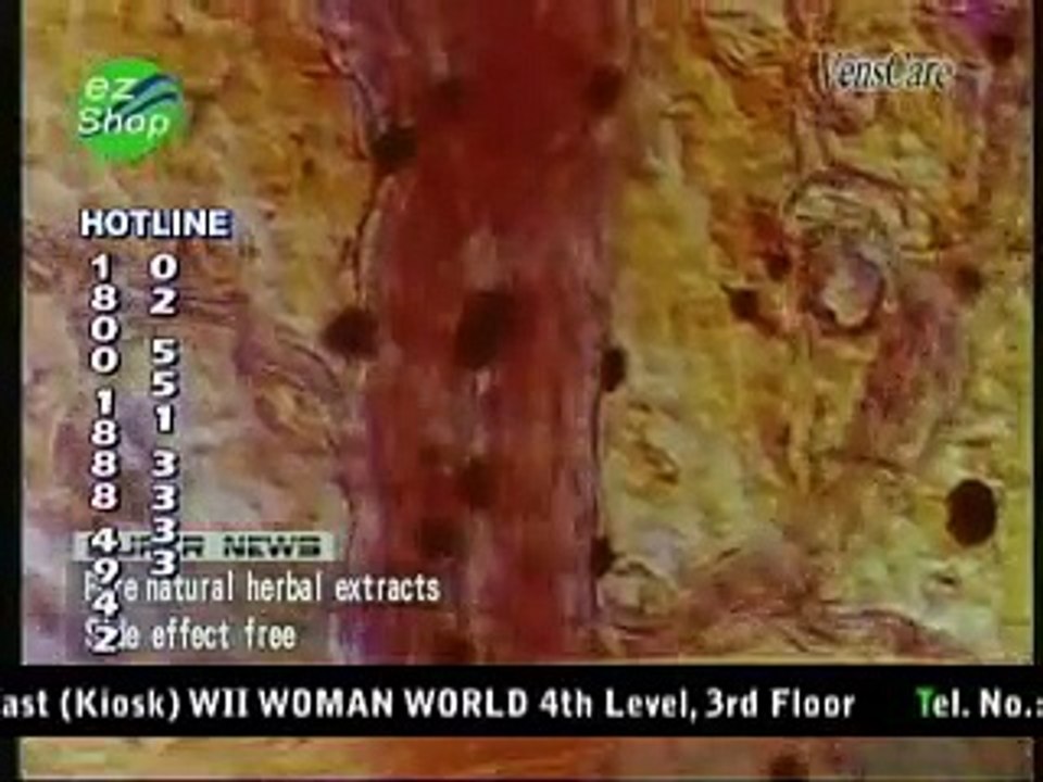 Venscare Varicose Veins Remover (www.myezshopmall.com)