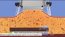ساعة صباح .. نحت الجسم بالليزر والتخلص من الدهون بدون جراحة