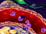 Introduction to Cancer Biology Part 4) Angiogenesis