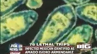 TUBERCULOSIS BROUGHT IN BY MEXICAN  ILLEGAL ALIENS