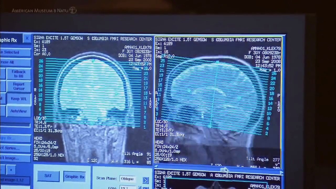 How to Double your Brain's Performance (1/4)