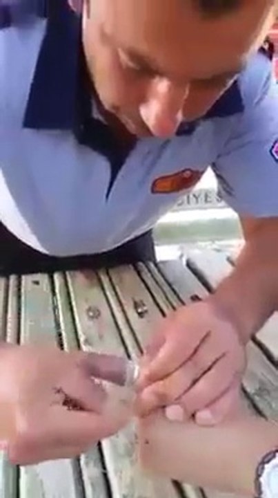 Doctor said to cut off the finger, Jeweler said Try to Recover