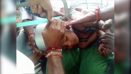 Carpinteiro salva menino que prendeu cabeça em panela de pressão