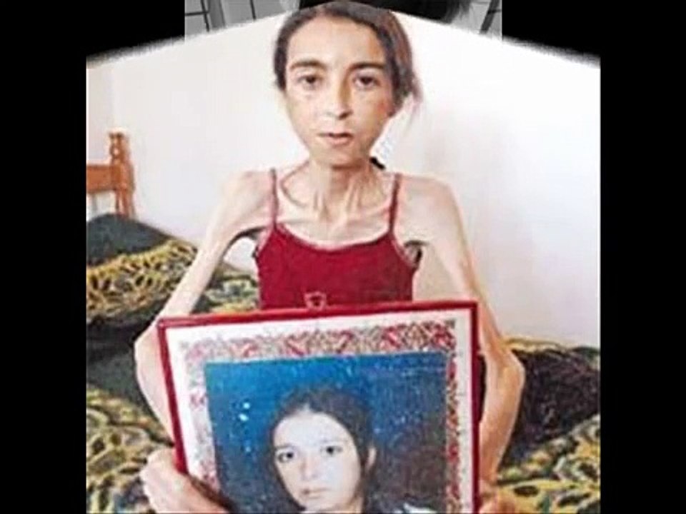 Anoreksi (til maria)