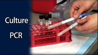 Pertussis Testing Video: Collecting a Nasopharyngeal Swab Clinical Specimen