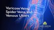 Varicose Veins, Spider Veins, and Venous Ulcers | Q&A