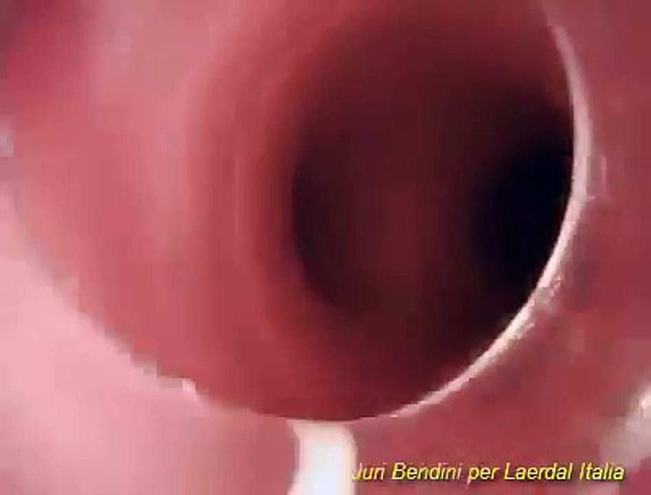 ALS Simulator Intubation