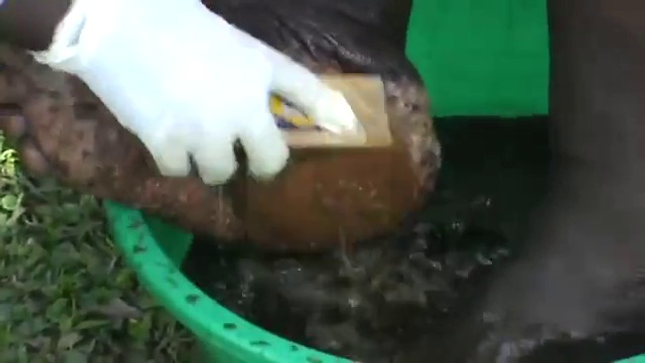 William's swollen feet testify to the horror of jigger attack