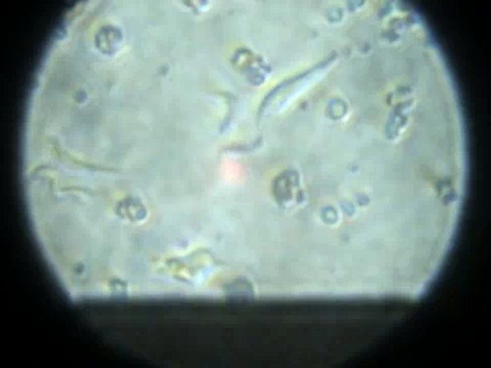 Trypanosoma