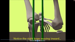 Outside knee pain? Are you frying your lateral meniscus?